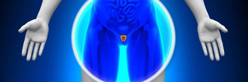 Prostat Kanseri Tedavisi