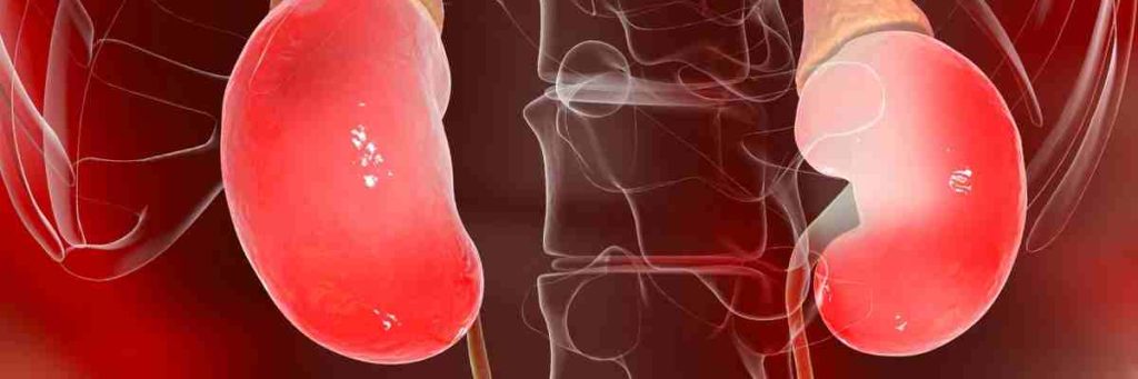 Böbrek Kisti