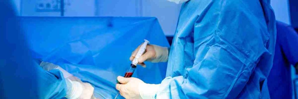 Sertleşme Bozukluğunda Kök Hücre Tedavisi